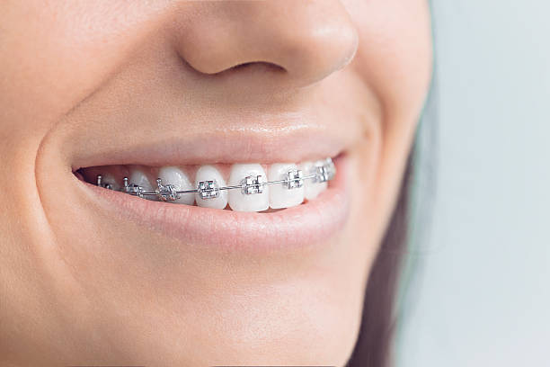 Best Root Canal Treatment  in Macon, MO